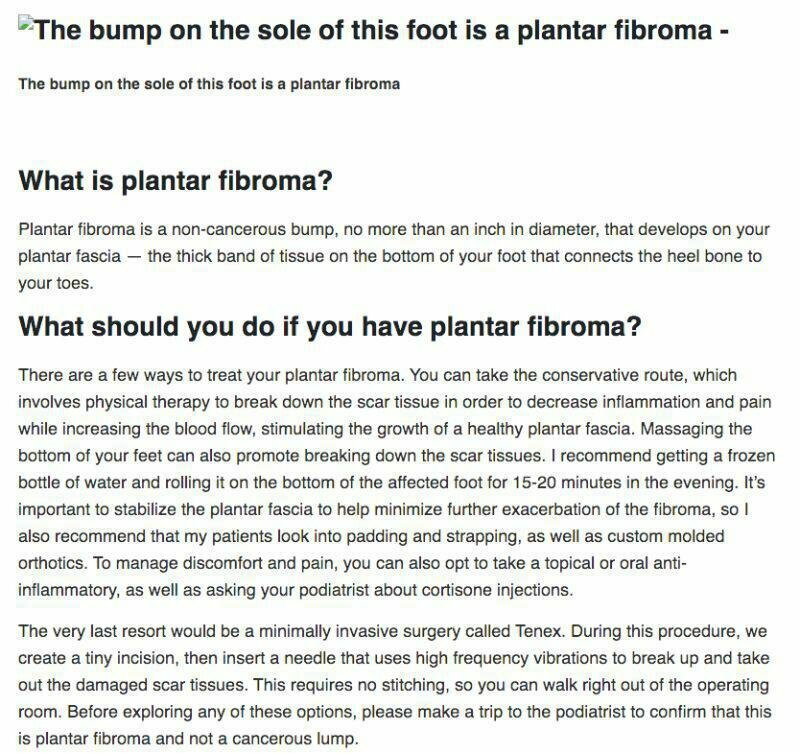 Dr. Cunha Authors A Piece On Plantar Fibroma For NAILS Magazine