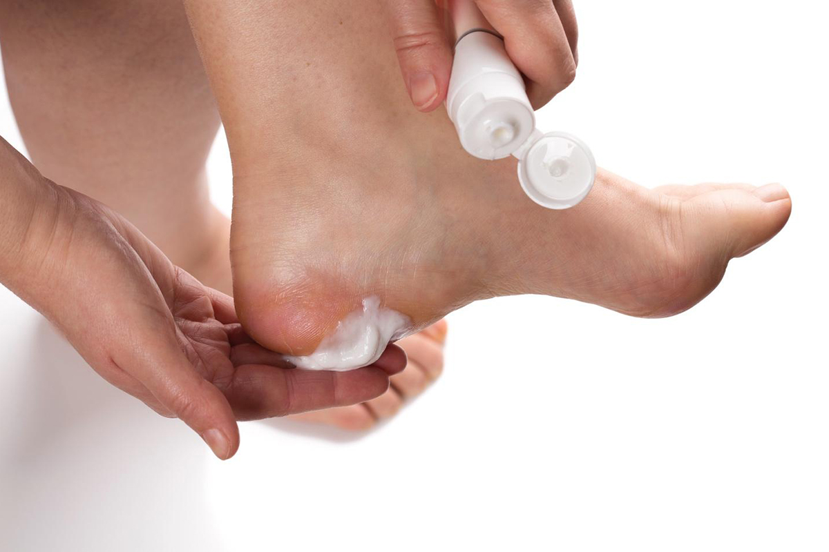 Best moisturizers for cracked heels this winter
