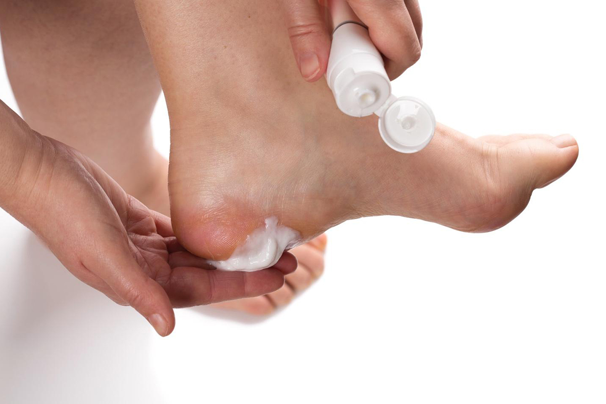 Best moisturizers for cracked heels this winter | Gotham Footcare