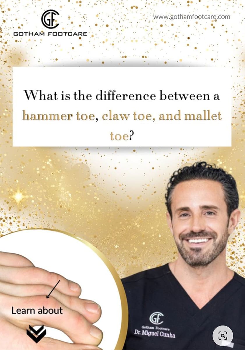 Questions about Hammer Toes, Claw Toes and Mallet Toes with image of Dr. Cunha, NYC Podiatrist