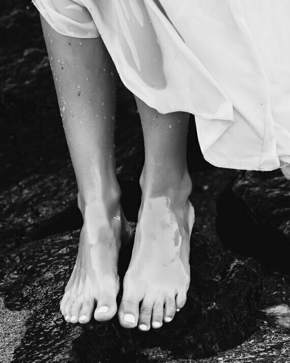 feet of patient for NYC Cosmetic Footcare