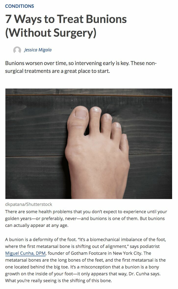 7 Ways to Treat Bunions (Without Surgery)