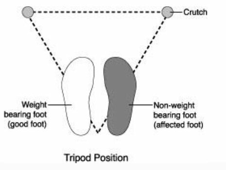 Properly Positioning Crutches Illustration