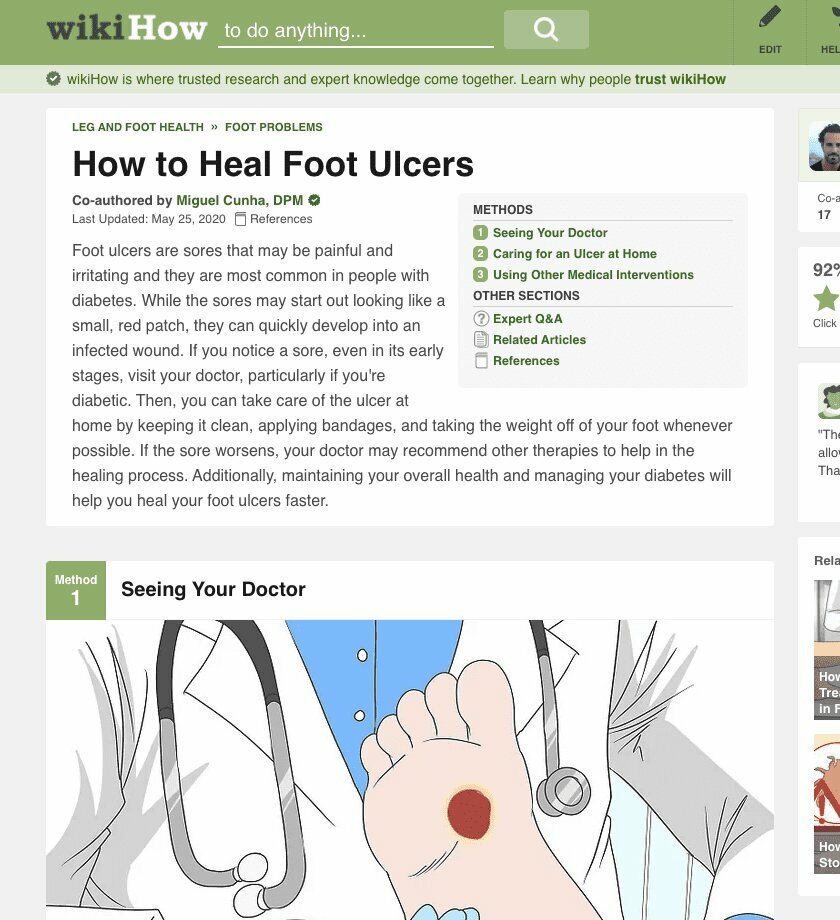 Dr. Cunha Shares How To Heal Foot Ulcers With wikiHow